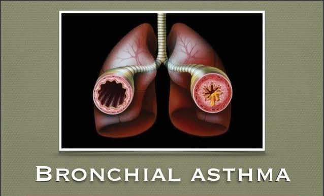 Drugs for Bronchial Asthma