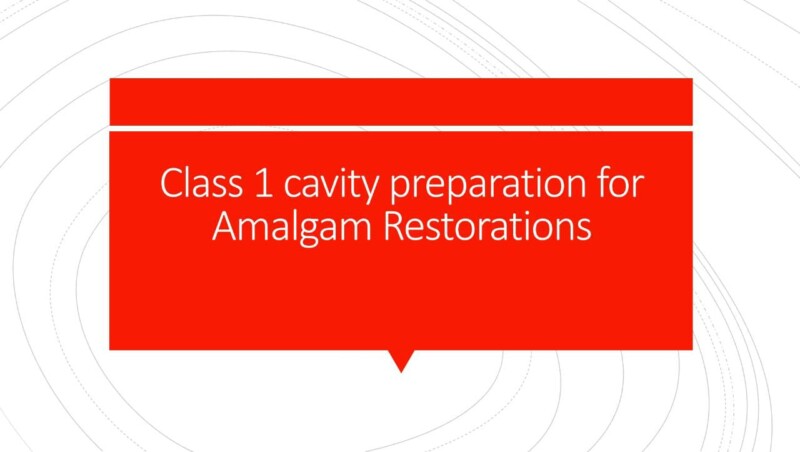 CLASS 1 CAVITY PREPARATION FOR AMALGAM RESTORATIONS