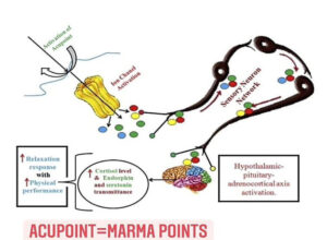 acupoint