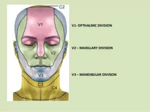 Trigeminal neuralgia