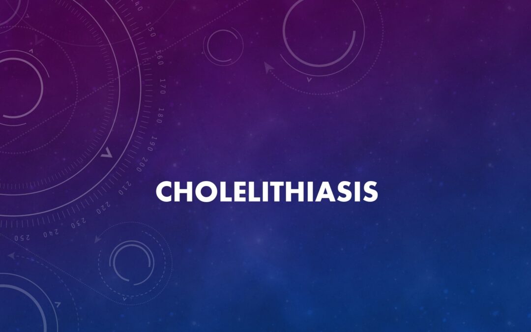 Cholelithiasis