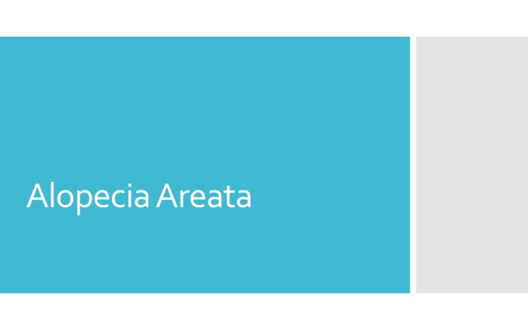 Alopecia Areata