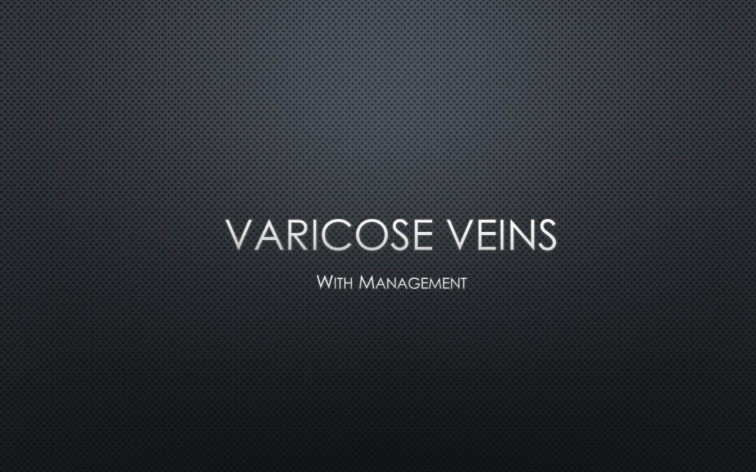 Varicose veins & it’s management