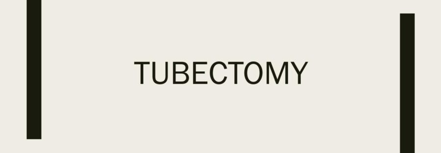 tubectomy
