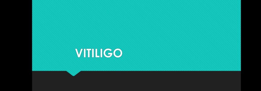 Vitiligo