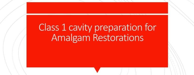 class 1 cavity preparation
