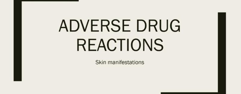 adverse drug reactions