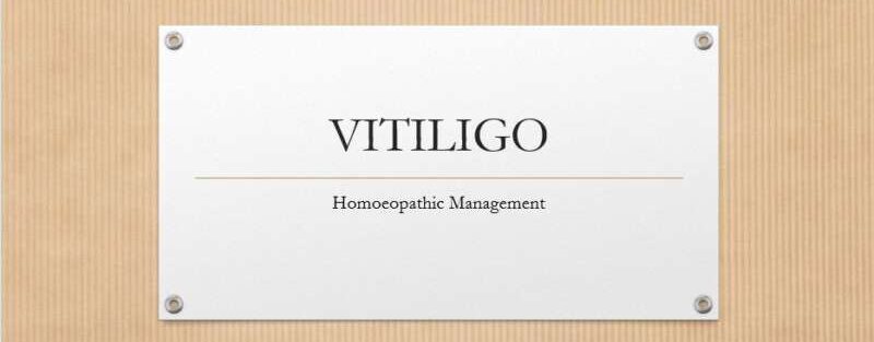 vitiligo medxlife