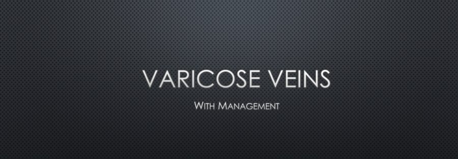 Varicose veins